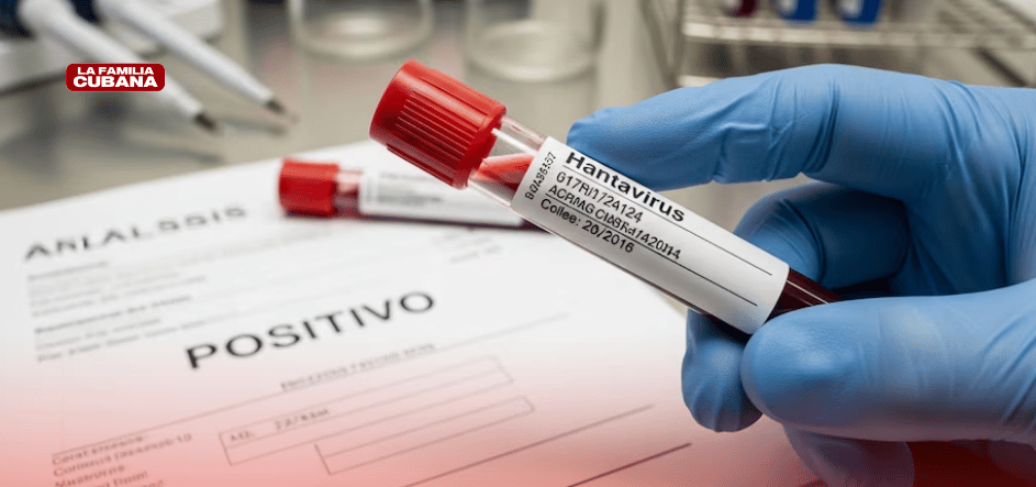 hanatavirus test